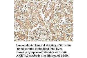 Image no. 1 for anti-Aflatoxin Beta1 Aldehyde Reductase (AKR7A2) antibody (ABIN791187) (AKR7A2 anticorps)