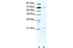 WB Suggested Anti-BTF3 Antibody Titration:  1. (BTF3 anticorps  (Middle Region))