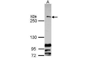 WB Image Sample (30 ug of whole cell lysate) A: Raji 5% SDS PAGE antibody diluted at 1:1000 (CENPF anticorps  (C-Term))
