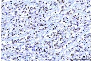 IHC analysis of RBM15B using anti-RBM15B antibody (ABIN7600219). (RBM15B anticorps  (AA 164-890))