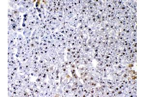 IHC analysis of VEGF Receptor 3 using anti-VEGF Receptor 3 antibody .