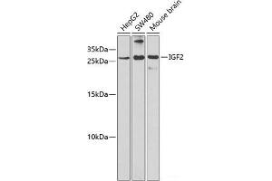 Western blot analysis of extracts of various cell lines using IGF2 Polyclonal Antibody at dilution of 1:1000. (IGF2 anticorps)
