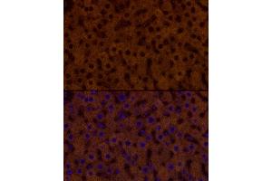 Immunofluorescence analysis of rat liver cells using PAH Rabbit mAb (ABIN7269264) at dilution of 1:25 (40x lens). (Phenylalanine Hydroxylase anticorps)