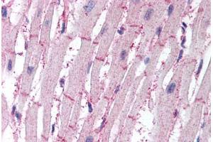 Human Heart (formalin-fixed, paraffin-embedded) stained with ATG4B antibody ABIN295502 at 10 ug/ml followed by biotinylated goat anti-rabbit IgG secondary antibody ABIN481713, alkaline phosphatase-streptavidin and chromogen. (ATG4B anticorps  (AA 350-400))
