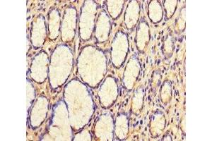 Immunohistochemistry of paraffin-embedded human stomach tissue using ABIN7175770 at dilution of 1:100 (WDR54 anticorps  (AA 1-334))