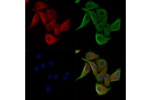 Phospho-MYPT1 (Ser852) Antibody staining Hela cells(heat shock treatment) by IF/ICC. (PPP1R12A anticorps  (pSer852))