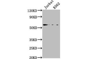 Western Blot Positive WB detected in: Jurkat whole cell lysate, K562 whole cell lysate All lanes: HMGXB4 antibody at 1:2000 Secondary Goat polyclonal to rabbit IgG at 1/50000 dilution Predicted band size: 66 kDa Observed band size: 66 kDa (HMGXB4 anticorps  (AA 489-509))