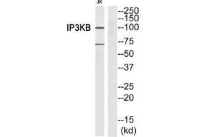 Western Blotting (WB) image for anti-Inositol-Trisphosphate 3-Kinase B (ITPKB) (Internal Region) antibody (ABIN1849284) (ITPKB anticorps  (Internal Region))
