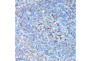 Immunohistochemistry of paraffin-embedded mouse spleen using CXCR1 antibody (ABIN7266317) at dilution of 1:100 (40x lens). (CXCR1 anticorps  (AA 250-350))