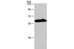 Western Blot analysis of Mouse brain tissue using KCNG4 Polyclonal Antibody at dilution of 1:550 (KCNG4 anticorps)