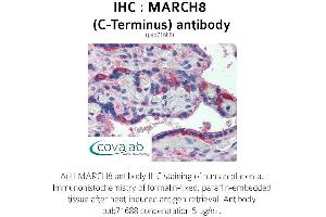 Image no. 1 for anti-Membrane-Associated Ring Finger (C3HC4) 8, E3 Ubiquitin Protein Ligase (MARCH8) (C-Term) antibody (ABIN1736759)