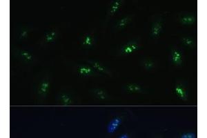 Immunofluorescence analysis of U-2 OS cells using HNF4G Polyclonal Antibody at dilution of 1:100 (40x lens). (HNF4 gamma anticorps)
