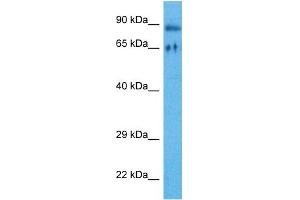 Host:  Rabbit  Target Name:  RIPK4  Sample Tissue:  Human HT1080 Whole Cell  Antibody Dilution:  1ug/ml (RIPK4 anticorps  (Middle Region))