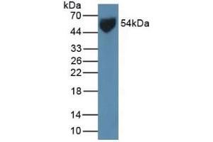 Rabbit Detection antibody from the kit in WB with Positive Control: Sample Human Serum.