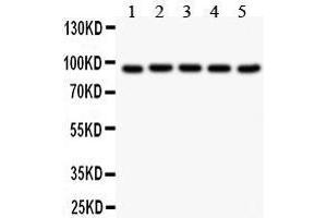 Western Blotting (WB) image for anti-Villin 1 (VIL1) (AA 770-799), (C-Term) antibody (ABIN3042343) (Villin 1 anticorps  (C-Term))