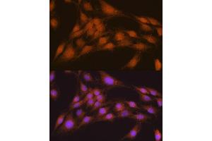 Immunofluorescence analysis of C6 cells using NRBF2 antibody  at dilution of 1:100. (NRBF2 anticorps  (AA 10-220))