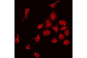 ABIN6275220 staining HepG2 by IF/ICC. (MBL2 anticorps  (N-Term))