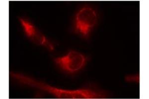 Image no. 2 for anti-Microtubule-Associated Protein tau (MAPT) (pSer356) antibody (ABIN319219) (MAPT anticorps  (pSer356))