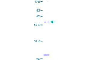 SDS-PAGE (SDS) image for UL16 Binding Protein 2 (ULBP2) (AA 1-246) protein (GST tag) (ABIN1324618)