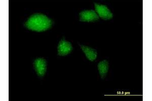 Immunofluorescence of purified MaxPab antibody to GCK on HeLa cell.