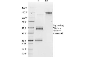 SDS-PAGE Analysis Purified Vitronectin Receptor Mouse Monoclonal Antibody (23C6). (CD51 anticorps)