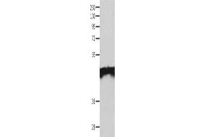 Gel: 10 % SDS-PAGE, Lysate: 40 μg, Lane: Jurkat cells, Primary antibody: ABIN7130184(MAT1A Antibody) at dilution 1/200, Secondary antibody: Goat anti rabbit IgG at 1/8000 dilution, Exposure time: 2 minutes (MAT1A anticorps)