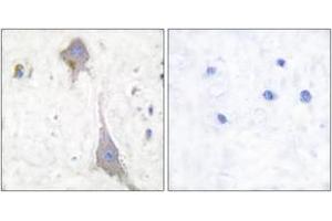 Immunohistochemistry (IHC) image for anti-Glutamate Receptor, Metabotropic 7 (GRM7) (AA 866-915) antibody (ABIN2889207) (GRM7 anticorps  (AA 866-915))
