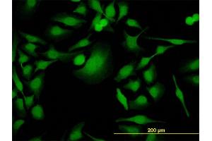 anti-PDZ Binding Kinase (PBK) (AA 1-110) antibody
