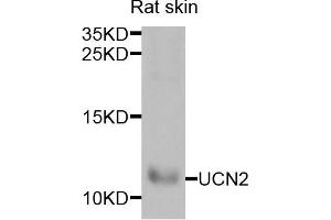 Western blot analysis of extracts of rat skin cells, using UCN2 antibody. (Urocortin 2 anticorps)