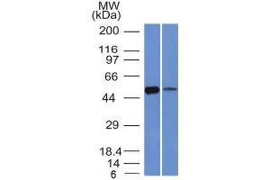 Western Blot of K562 and Lung lysate ALDH1A1 Mouse Monoclonal Antibody (ALDH1A1/1381). (ALDH1A1 anticorps  (AA 315-434))