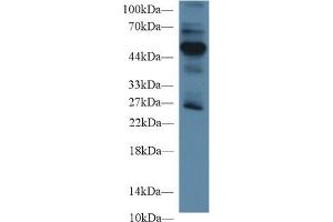 Detection of RAGE in Mouse Lung lysate using Polyclonal Antibody to Receptor For Advanced Glycation Endproducts (RAGE) (RAGE anticorps  (AA 91-274))