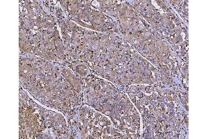 IHC analysis of HLA-DRA using anti-HLA-DRA antibody (ABIN7600949).