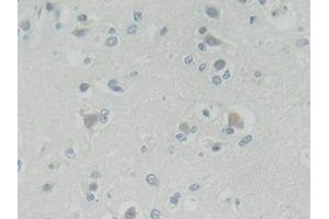 Detection of ROR2 in Human Cerebrum Tissue using Polyclonal Antibody to Receptor Tyrosine Kinase Like Orphan Receptor 2 (ROR2) (ROR2 anticorps  (AA 683-934))