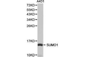 Western Blotting (WB) image for anti-Small Ubiquitin Related Modifier Protein 1 (SUMO1) antibody (ABIN1874993) (SUMO1 anticorps)