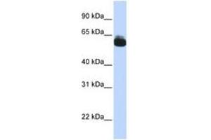 Image no. 1 for anti-Frizzled Family Receptor 9 (FZD9) (AA 144-193) antibody (ABIN6740722) (FZD9 anticorps  (AA 144-193))