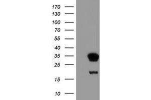 Western Blotting (WB) image for anti-Nicotinamide N-Methyltransferase (NNMT) antibody (ABIN1499793) (NNMT anticorps)