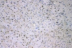 IHC analysis of ADO using anti-ADO antibody (ABIN4886431). (ADO anticorps  (AA 49-261))