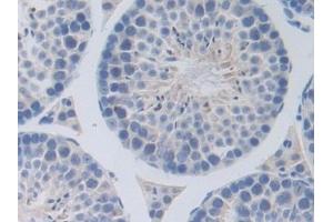 Detection of ErbB3 in Mouse Testis Tissue using Polyclonal Antibody to V-Erb B2 Erythroblastic Leukemia Viral Oncogene Homolog 3 (ErbB3)