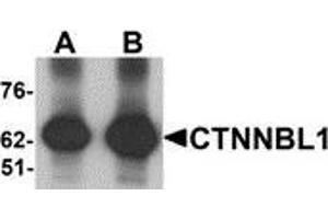 Western blot analysis of CTNNBL1 in human brain tissue lysate with CTNNBL1 antibody at (A) 1 and (B) 2 μg/ml. (CTNNBL1 anticorps  (C-Term))