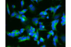 Immunofluorescent staining of SH-SY5Y cells (Second Panel). (CPE anticorps  (AA 49-200))