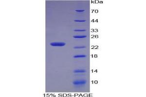 SDS-PAGE analysis of Human Matrix Metalloproteinase 3 (MMP3) Protein. (MMP3 Protéine)
