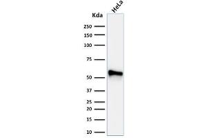 Western Blot Analysis of human HeLa cell lysate using Cytokeratin 7 Mouse Monoclonal Antibody (KRT7/760 + KRT7/903). (Cytokeratin 7 anticorps)