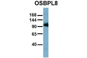 Host:  Rabbit  Target Name:  OSBPL8  Sample Type:  HT1080  Antibody Dilution:  1. (OSBPL8 anticorps  (Middle Region))