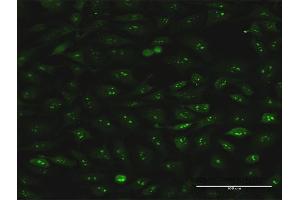 Immunofluorescence of monoclonal antibody to S100A7 on HeLa cell. (S100A7 anticorps  (AA 1-101))