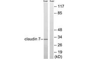 Western blot analysis of extracts from rat liver cells, using Claudin 7 (Ab-210) Antibody. (Claudin 7 anticorps  (AA 162-211))