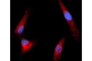 Immunofluorescence (IF) image for anti-Granzyme B (GZMB) (AA 21-247) antibody (APC) (ABIN5564760) (GZMB anticorps  (AA 21-247) (APC))