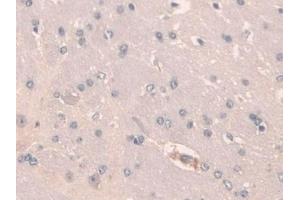 Detection of SCGN in Mouse Cerebrum Tissue using Polyclonal Antibody to Secretagogin (SCGN)