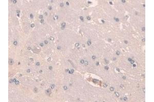 Detection of SCGN in Mouse Cerebrum Tissue using Polyclonal Antibody to Secretagogin (SCGN) (SCGN anticorps  (AA 1-276))