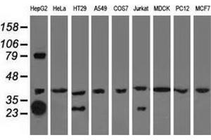 Western blot analysis of extracts (35 µg) from 9 different cell lines by using anti-QPRT monoclonal antibody. (QPRT anticorps)