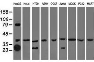 Western blot analysis of extracts (35 µg) from 9 different cell lines by using anti-QPRT monoclonal antibody.